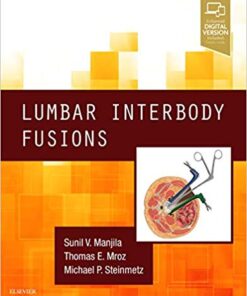 Lumbar Interbody Fusions 1st Edition PDF