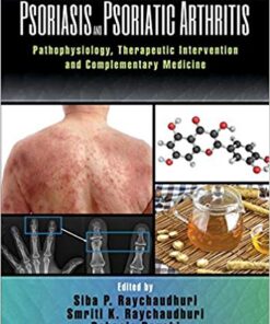 Psoriasis and Psoriatic Arthritis: Pathophysiology, Therapeutic Intervention, and Complementary Medicine 1st Edition PDF