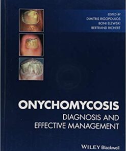 Onychomycosis: Diagnosis and Effective Management 1st Edition PDF