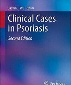 Clinical Cases in Psoriasis (Clinical Cases in Dermatology) 2nd ed. 2019 Edition PDF