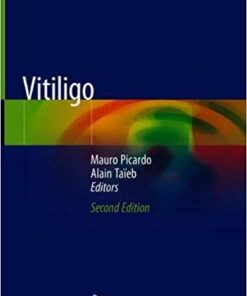 Vitiligo 2nd ed. 2019 Edition PDF