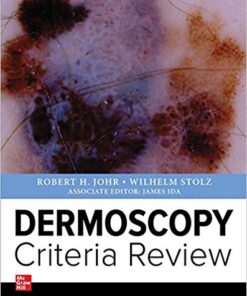 Dermoscopy Criteria Review 1st Edition PDF