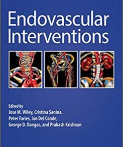 Endovascular Interventions 1st Edition PDF