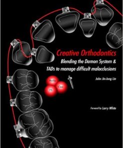 Creative Orthodontics Blending the Damon System & TADS to Manage Difficult Malocclusions PDF