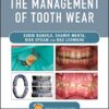 Practical Procedures in the Management of Tooth Wear PDF
