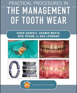 Practical Procedures in the Management of Tooth Wear PDF