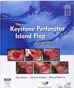 The Keystone Perforator Island Flap Concept, 1e 1st Edition PDF