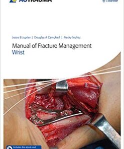 Manual of Fracture Management - Wrist 1st Edition PDF & VIDEO