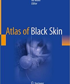 Atlas of Black Skin 1st ed. 2020 Edition PDF