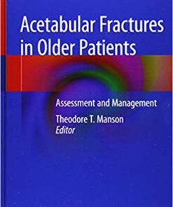 Acetabular Fractures in Older Patients: Assessment and Management 1st ed. 2020 Edition PDF