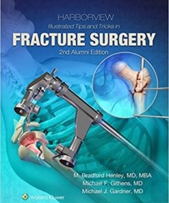 Harborview Illustrated Tips and Tricks in Fracture Surgery Second Edition PDF