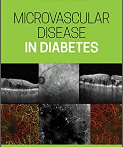 Microvascular Disease in Diabetes 1st Edition PDF