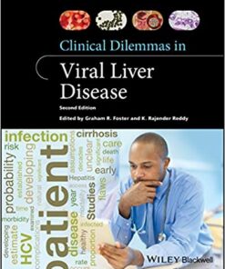 Clinical Dilemmas in Viral Liver Disease (Clinical Dilemmas (UK)) 2nd Edition PDF