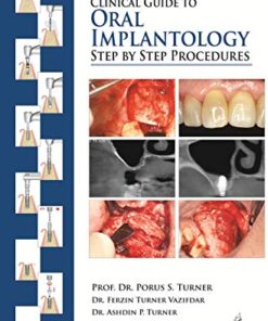 Clinical Guide to Oral Implantology: Step by Step Procedures PDF