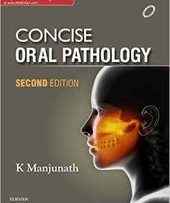 Concise Oral Pathology 2nd Edition, Kindle Edition PDF