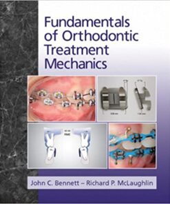 Fundamentals of Orthodontic Treatment Mechanics PDF