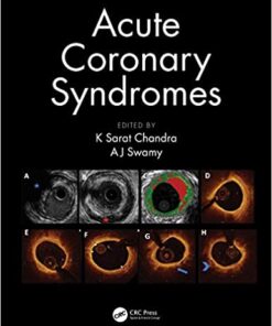 Acute Coronary Syndromes 1st Edition PDF