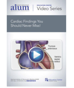 Cardiac Findings You Should Never Miss!