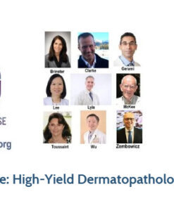 2020 Online Dermpedia CME Course: High-Yield Dermatopathology: Melanocytic Lesions