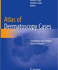 Atlas of Dermatoscopy Cases: Challenging and Complex Clinical Scenarios 1st ed. 2020 Edition PDF