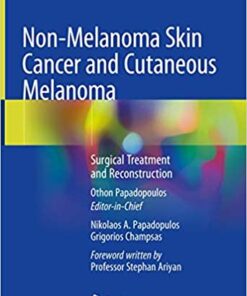 Non-Melanoma Skin Cancer and Cutaneous Melanoma: Surgical Treatment and Reconstruction 1st ed. 2020 Edition PDF