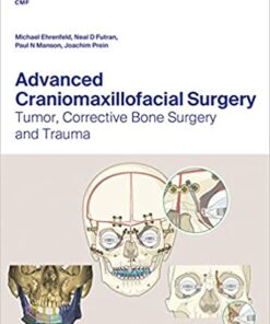 Advanced Craniomaxillofacial Surgery 1st Edition PDF
