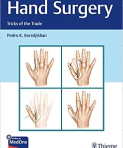 Hand Surgery (Tricks of the Trade) 1st Edition PDF