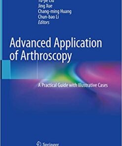 Advanced Application of Arthroscopy: A Practical Guide with Illustrative Cases 1st ed. 2020 Edition PDF