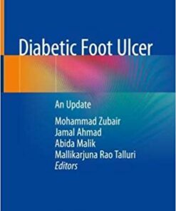 Diabetic Foot Ulcer: An Update 1st ed. 2021 Edition PDF