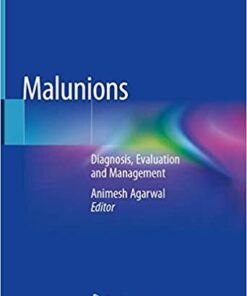 Malunions: Diagnosis, Evaluation and Management 1st ed. 2021 Edition PDF
