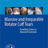 Massive and Irreparable Rotator Cuff Tears: From Basic Science to Advanced Treatments 1st ed. 2020 Edition PDF