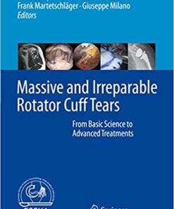Massive and Irreparable Rotator Cuff Tears: From Basic Science to Advanced Treatments 1st ed. 2020 Edition PDF