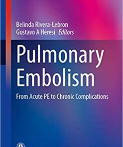 Pulmonary Embolism: From Acute PE to Chronic Complications PDF