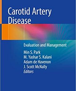 Carotid Artery Disease: Evaluation and Management 1st ed. 2020 Edition PDF
