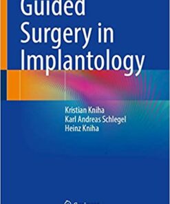 Guided Surgery in Implantology 1st ed. 2021 Edition PDF