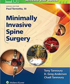 Minimally Invasive Spine Surgery First Edition PDF