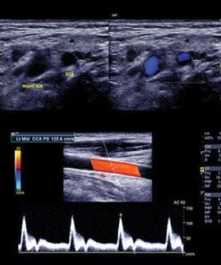 Clinical Approach to Vascular Ultrasound and RPVI Prep Course 2021