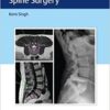 Instrumentation for Minimally Invasive Spine Surgery 1st Edition PDF