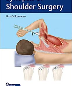 Synopsis of Shoulder Surgery 1st Edition PDF