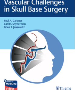 Vascular Challenges in Skull Base Surgery 1st Edition PDF & VIDEO