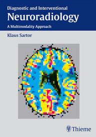 Diagnostic and Interventional Neuroradiology: A Multimodality Approach PDF