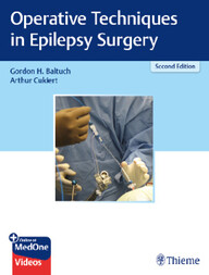 Operative Techniques in Epilepsy Surgery 2nd Edition PDF
