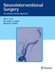 Neurointerventional Surgery: An Evidence-Based Approach 1st Edition PDF