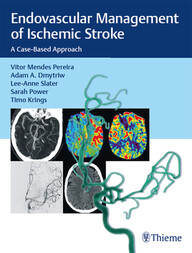 Endovascular Management of Ischemic Stroke: A Case-Based Approach 1st Edition PDF