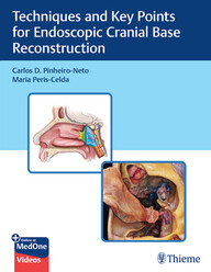 Video Techniques and Key Points for Endoscopic Cranial Base Reconstruction 1st Edition