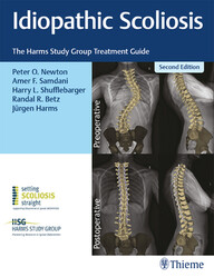 Idiopathic Scoliosis: The Harms Study Group Treatment Guide 2nd Edition PDF