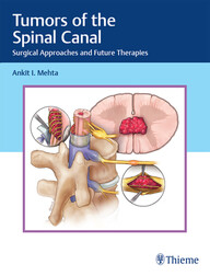 Tumors of the Spinal Canal: Surgical Approaches and Future Therapies 1st Edition PDF