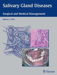 Salivary Gland Diseases: Surgical and Medical Management 1st Edition PDF