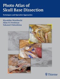 Photo Atlas of Skull Base Dissection: Techniques and Operative Approaches 1st Edition PDF
