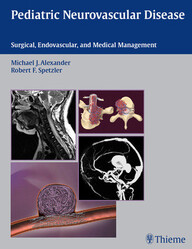 Pediatric Neurovascular Disease: Surgical, Endovascular and Medical Management 1st Edition PDF